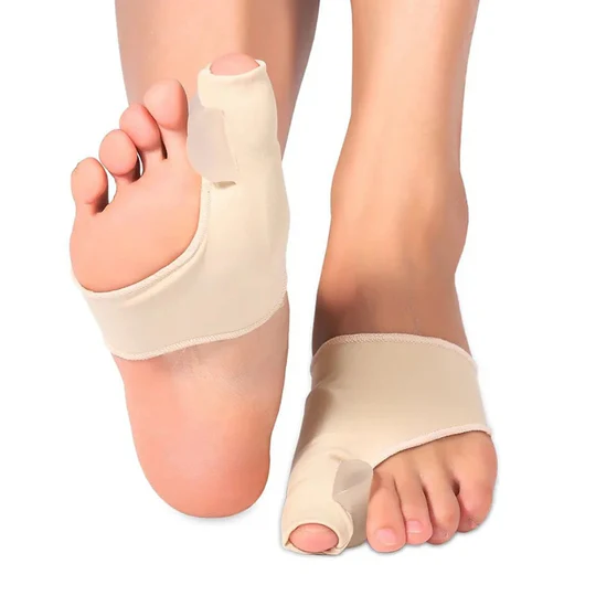 Bunions