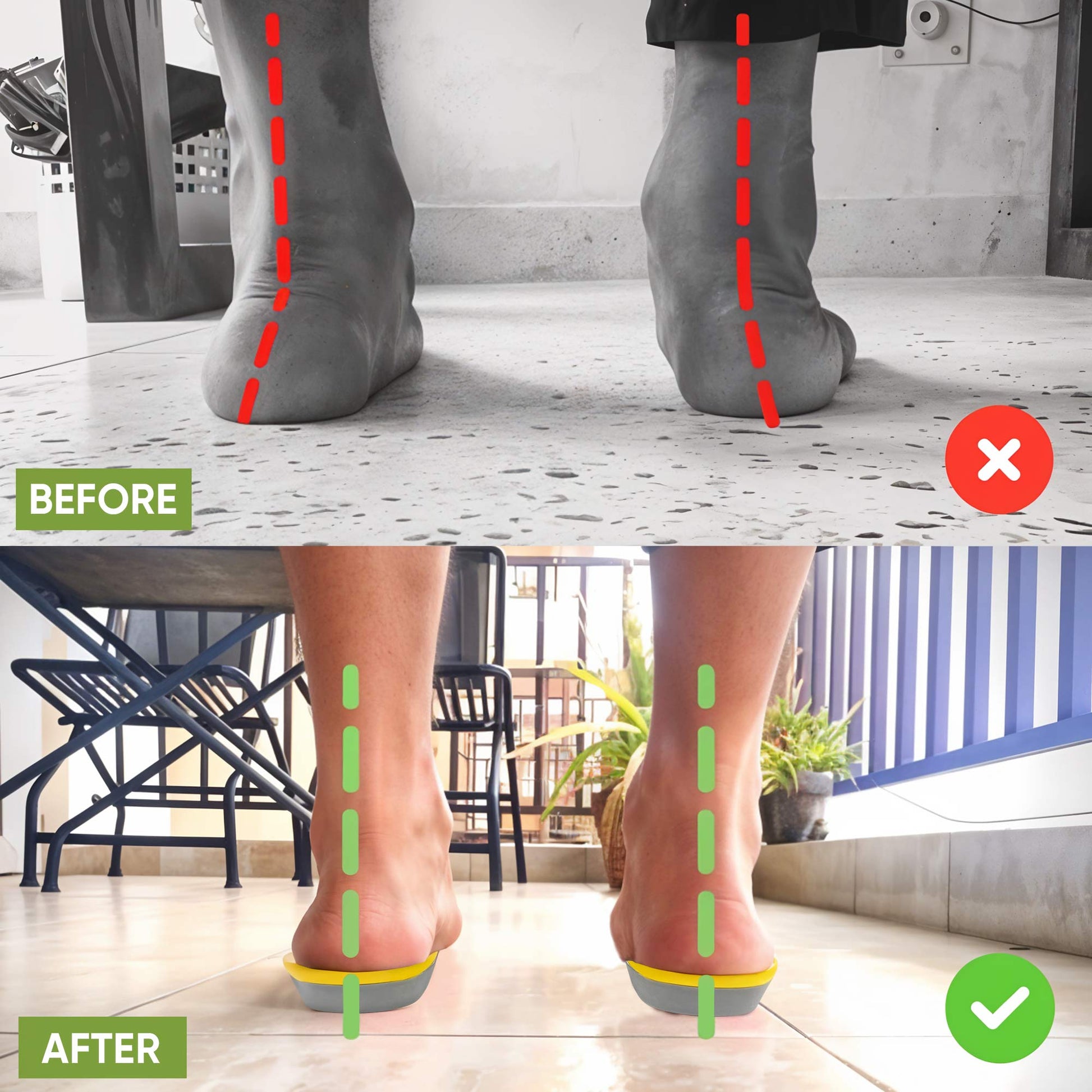 Trim-to-fit gel insoles with arch support for plantar fasciitis