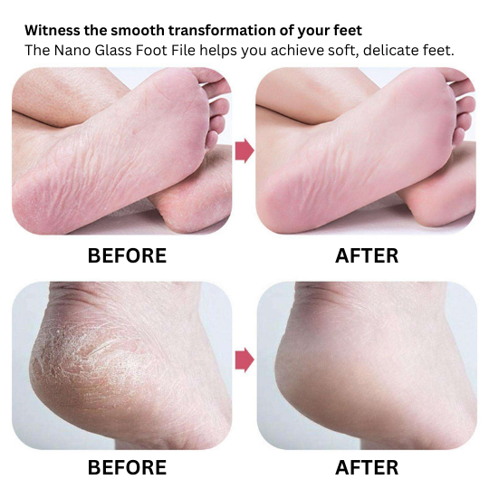 Nano glass foot file painless callus and dead skin remover