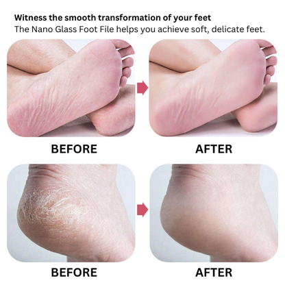 Nano glass foot file painless callus and dead skin remover