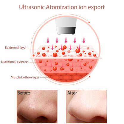 Ultrasonic facial skin scrubber spatula for pore cleansing